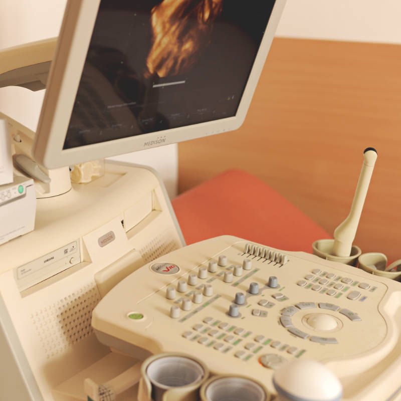 3D ultrazvuk - Gynekologická ordinace Žatec